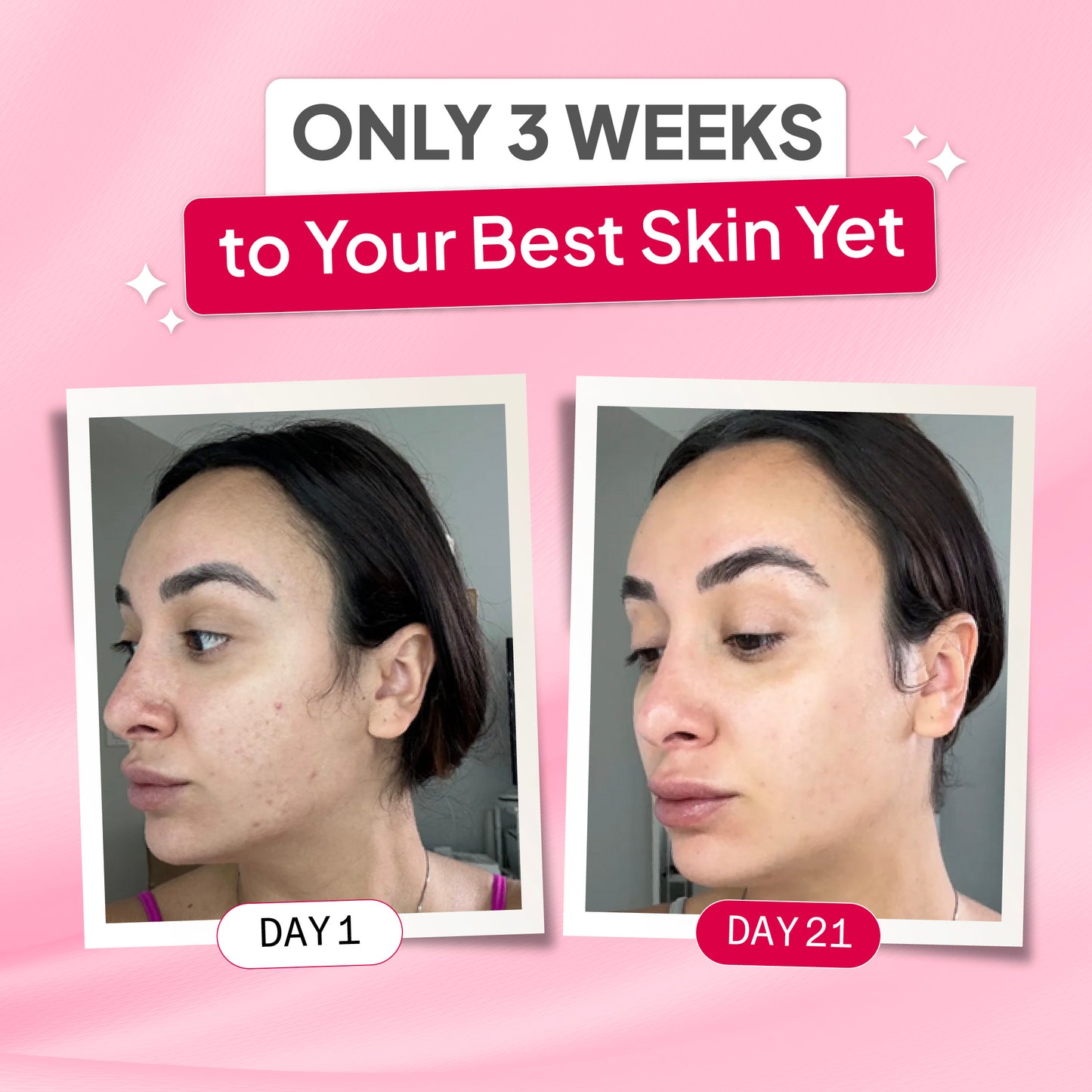 kojic acid & turmeric cleansing pads